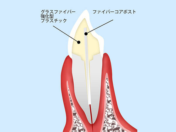 セラミック治療は保険診療と何が違うの・・・?